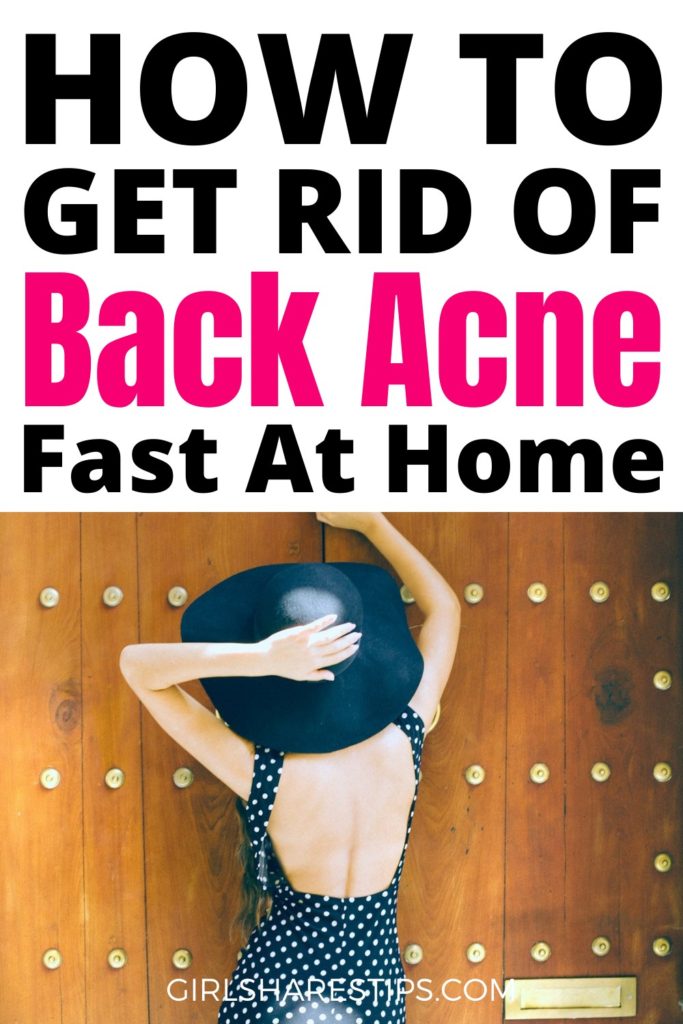 how to get rid of back acne fast at home